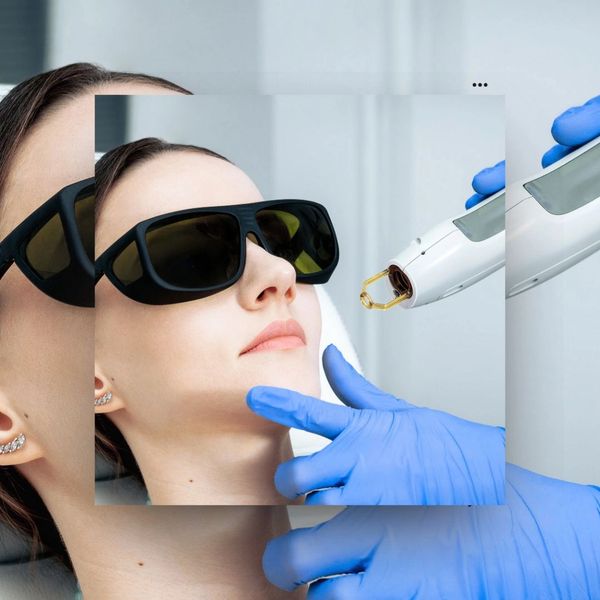 Laser Age spot treatment Polished Aesthetics, LLC